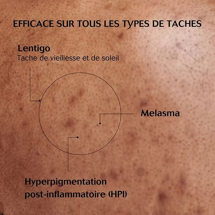  Skin pigmentation and blemishes removal cream for the face and hands - Sibilia 