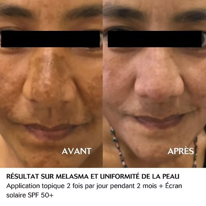  Skin pigmentation and blemishes removal cream for the face and hands - Sibilia 