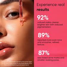  Dark Spot Correcting Serum 10% Niacinamide 4% TXA - ANUA 