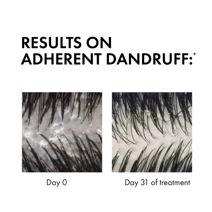  Dercos Anti-Dandruff Shampoo for Dry Scalp 200ml - Vichy 