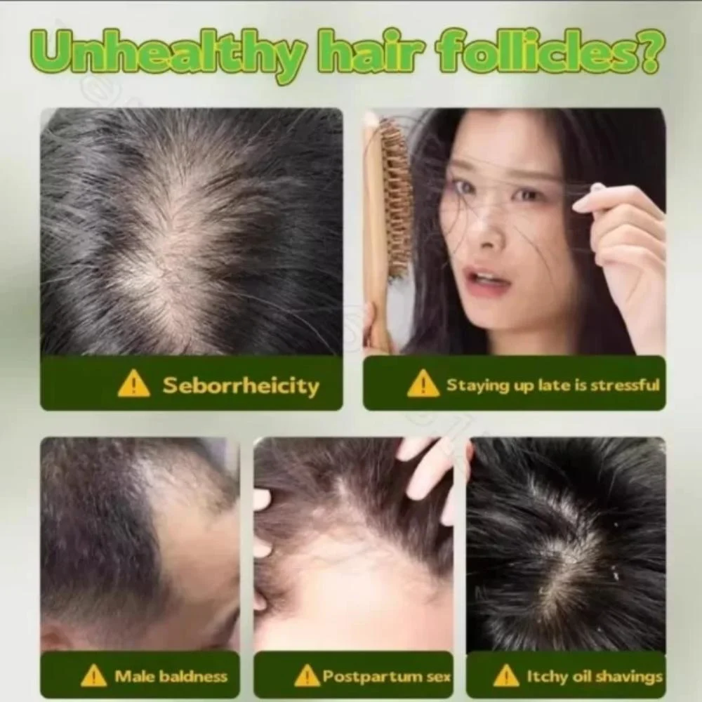  Seven Green Natural Herbal Soap to Promote Hair Growth and Reduce Hair Loss 120g 