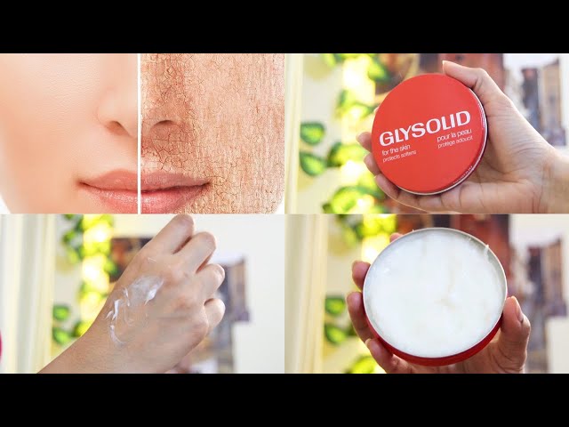  GLYSOLID SKIN AND HAND CREAM with Glycerin and Allantoin is designed to treat sensitive 250ml 