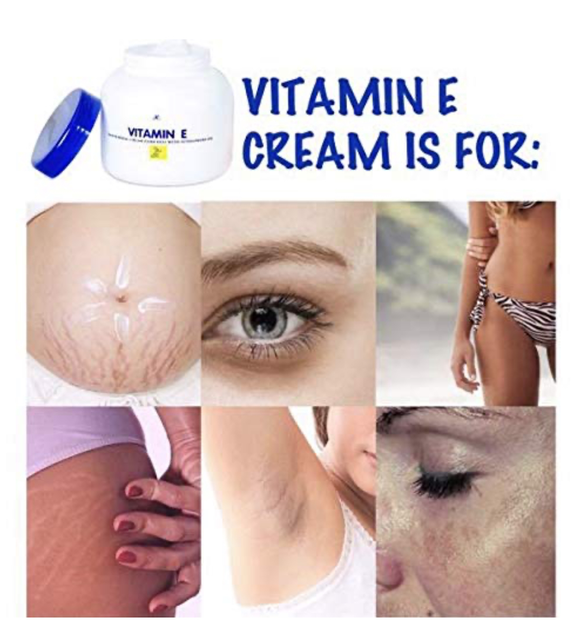  كريم فيتامين E مرطب للبشرة (Vitamin E Moisturising Cream) – عبوة بغطاء أزرق 