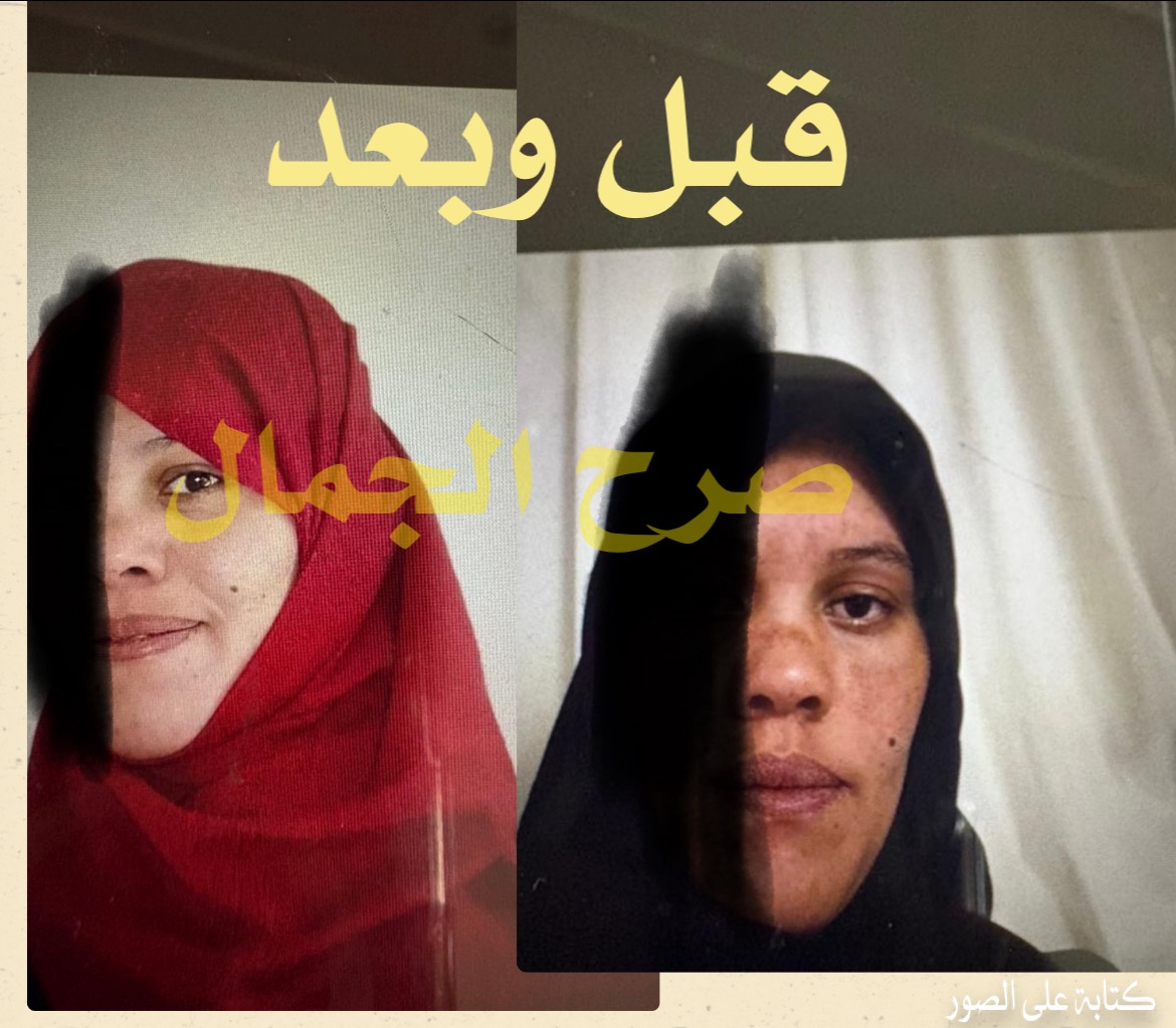  كريم عرق السوس لتفتيح البشرة وتوحيد اللون من نورفينا 