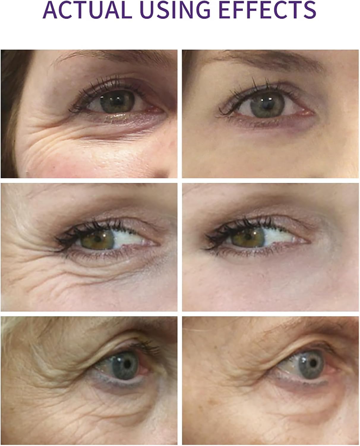  RETINOL EYE سيروم ريتينول تحت العين رول المضاد للشيخوخة 