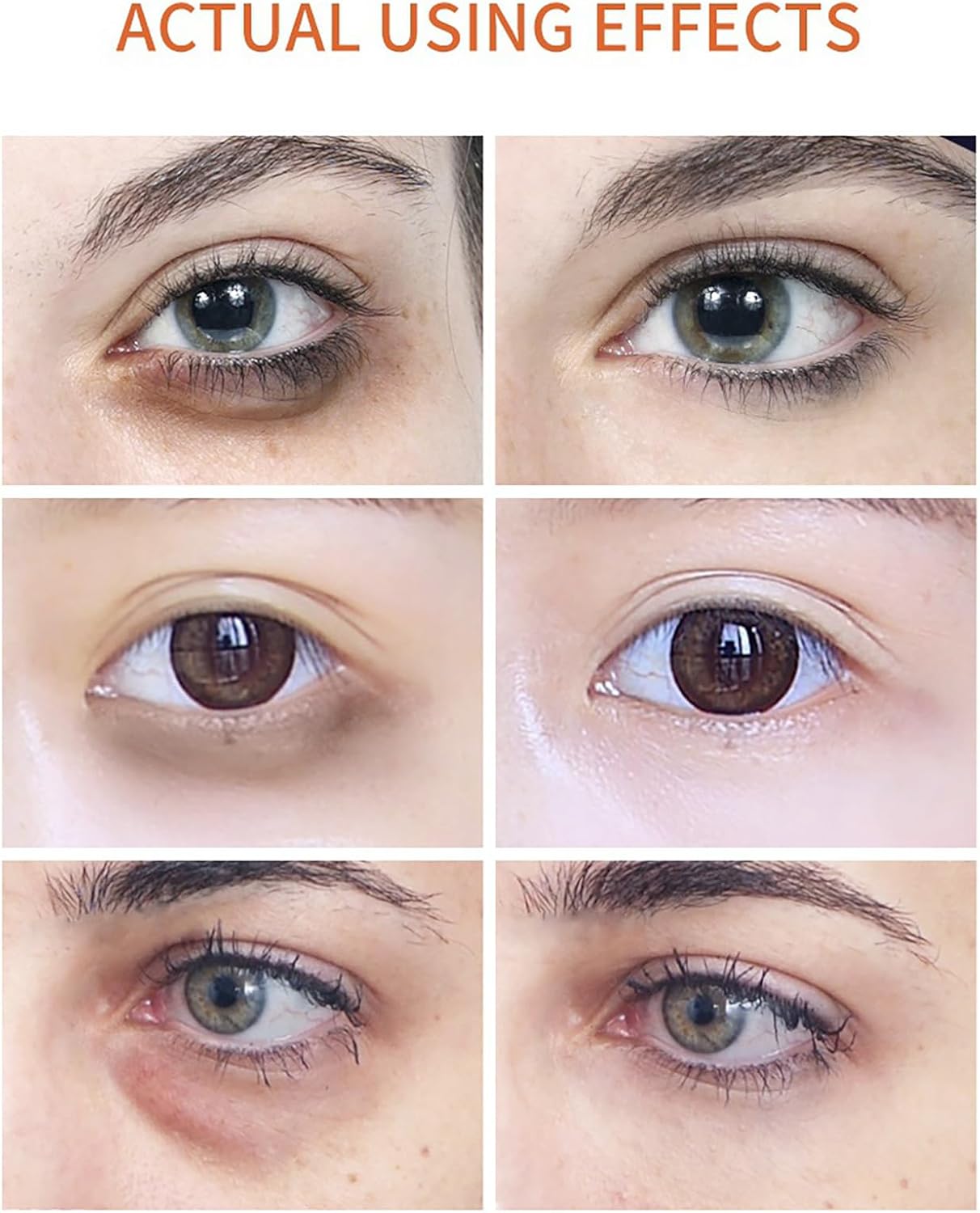  Vitamin C Eye سيروم فيتامين سي تحت العين رول مضاد للشيخوخة 
