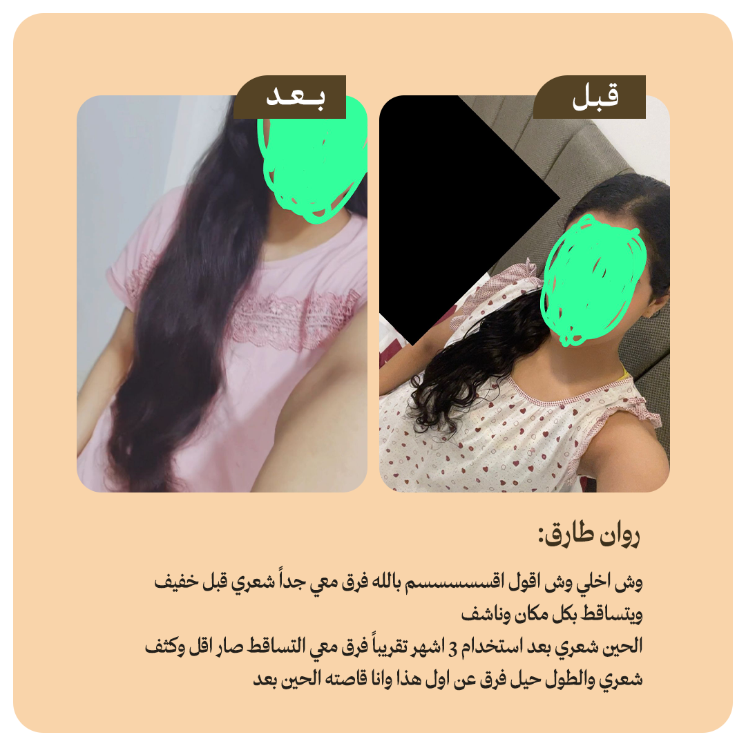 collection-img