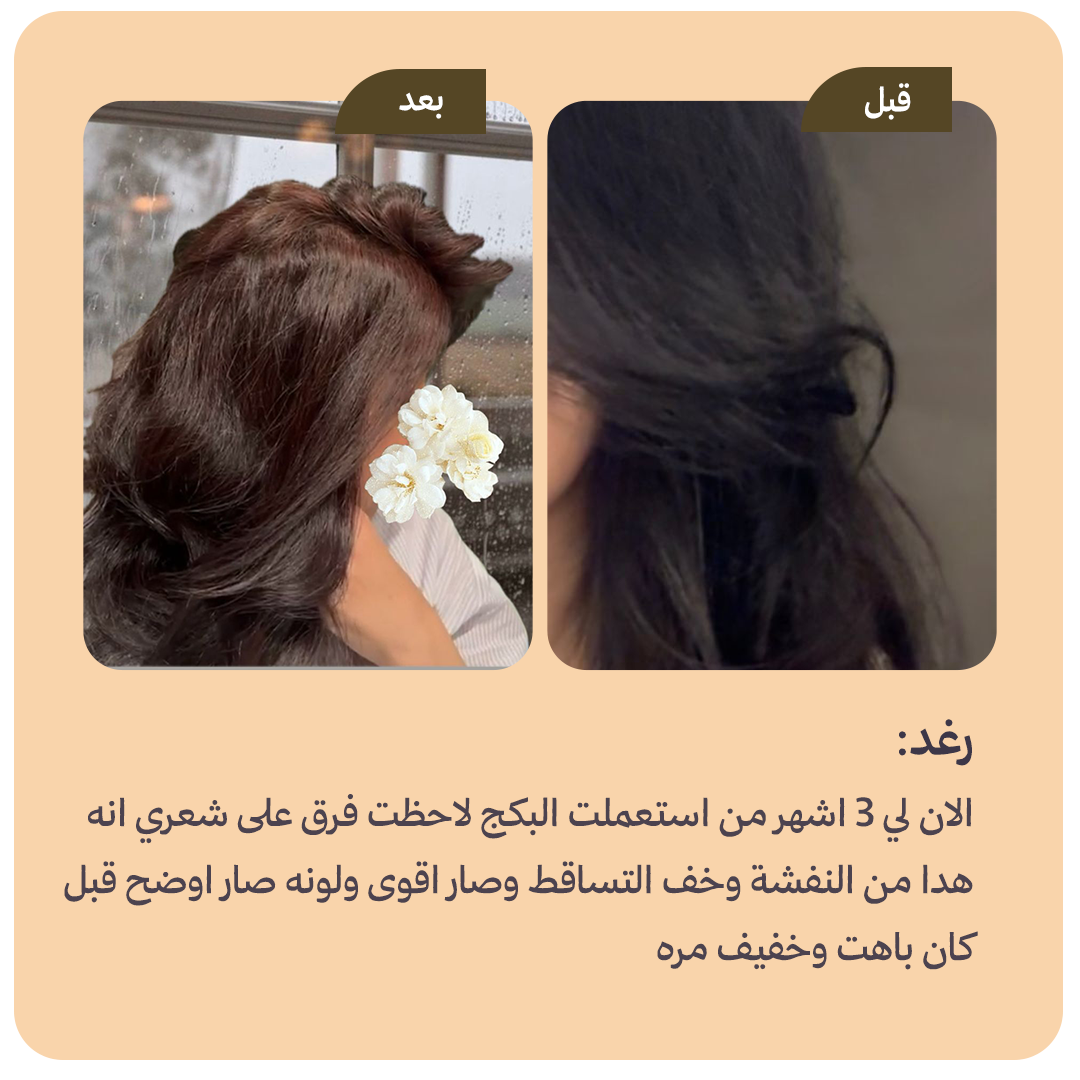 collection-img