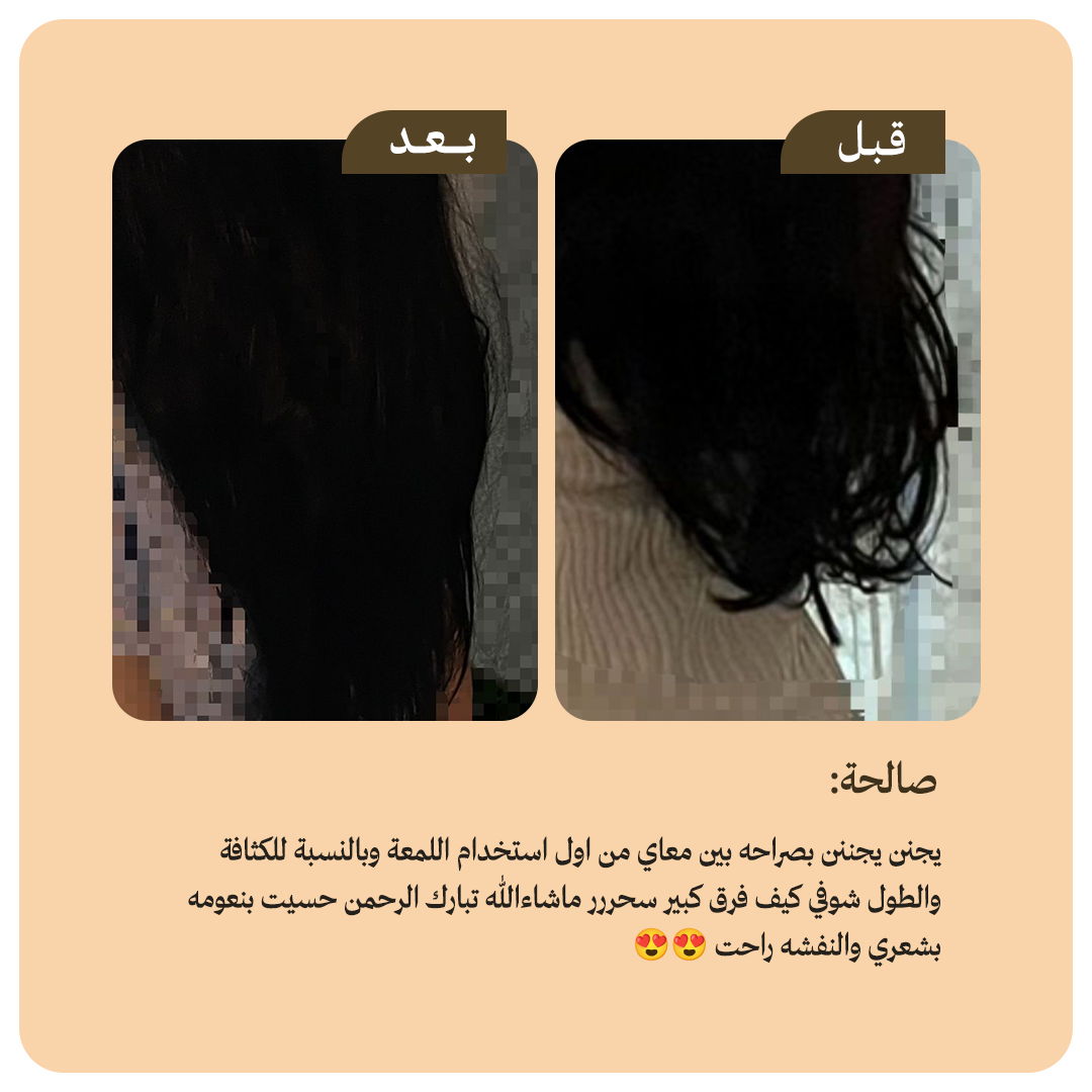 collection-img