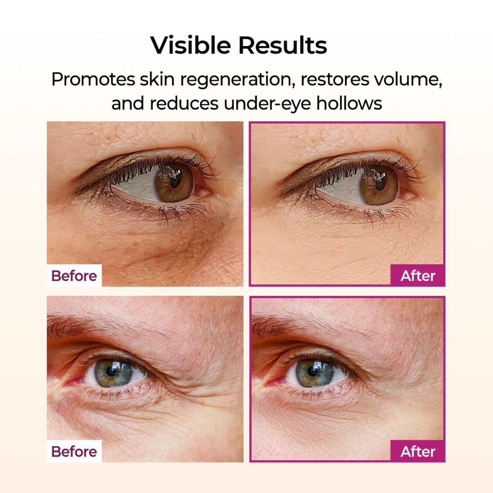 Dr. Melaxin Cemenrete Calcium Volume Multi Balm 