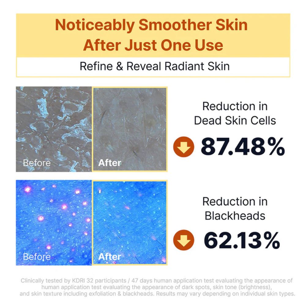Sungboon Editor Kojic Acid Niacinamide Brightening Rice Peel Shot 