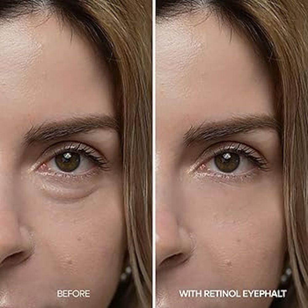 Dr. Melaxin Eyephalt Retinol Eyebag Cream 
