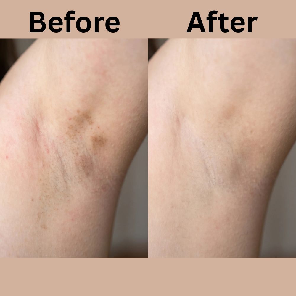 Dermadoctor Total Nonscents Brightening Ultra-Gentle Antiperspirant