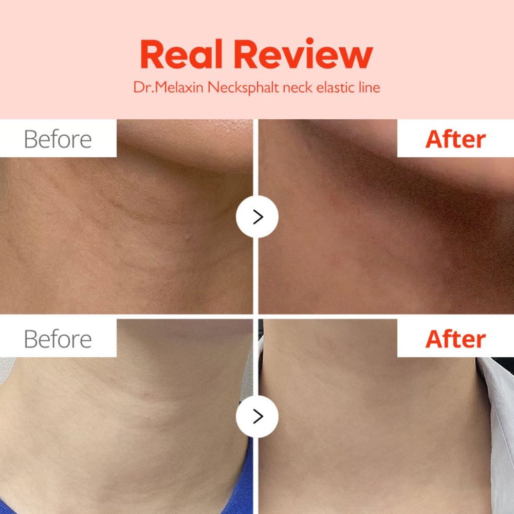 Dr. Melaxin Necksphalt ECM Ceramide Neck Serum