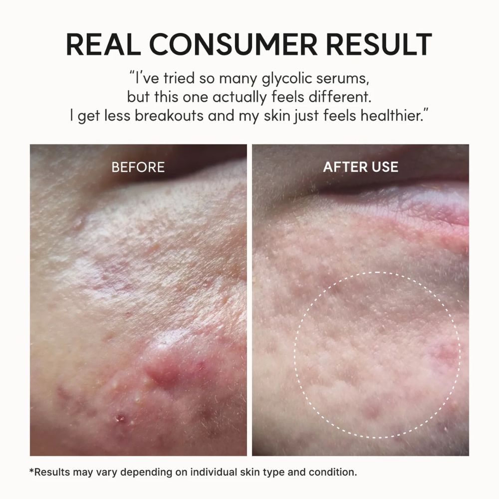 Arencia Eraser Shot Glycolic Acid Booster 