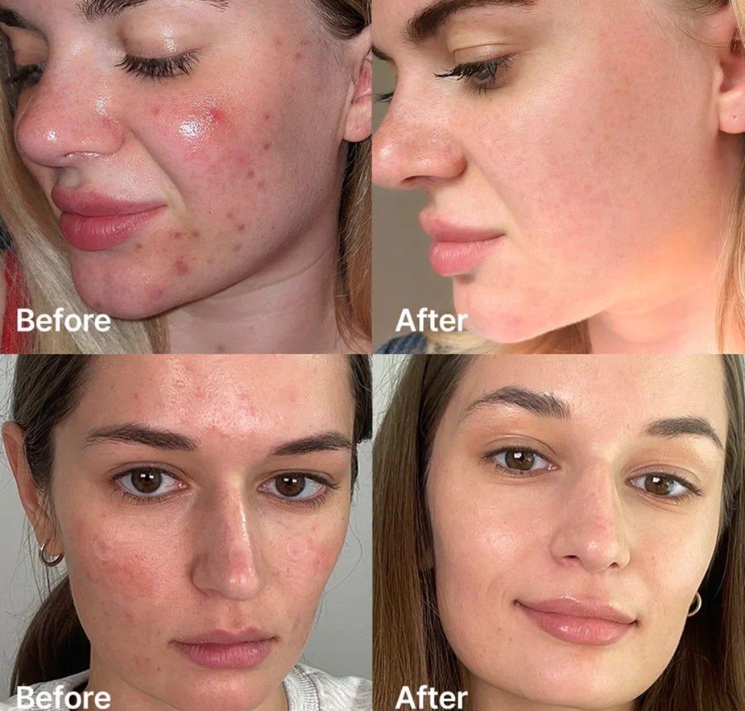  سيروم لتصفية البشرة بحمض السكسينيك من ميديكيوب - 30مل 