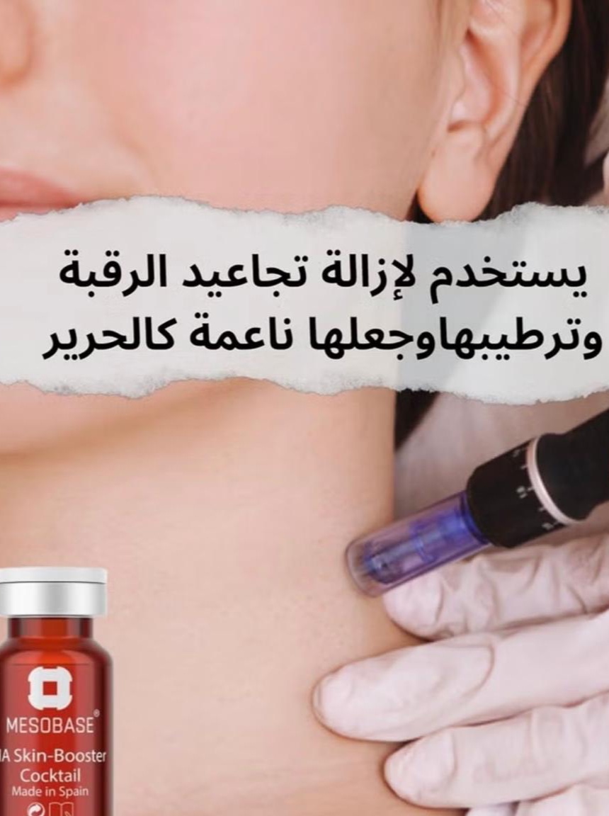 ميزوثيرابي خلايا جذعية بي آر بي