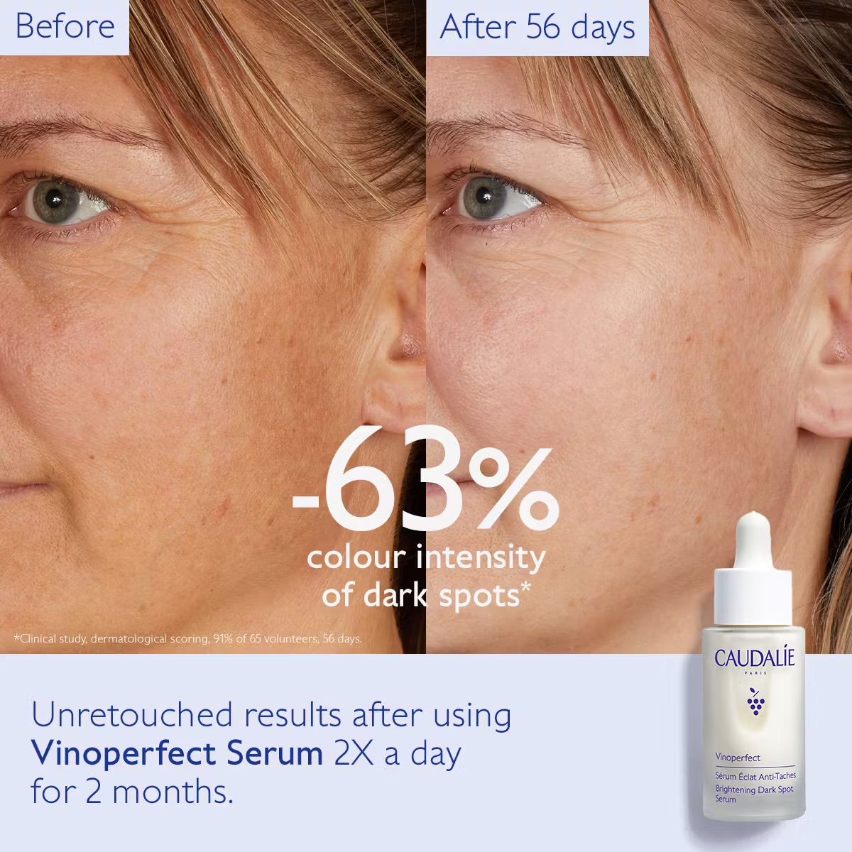  Caudalie Vinoperfect Dark Spot Brightening Serum – بديل فيتامين C لتفتيح البشرة 