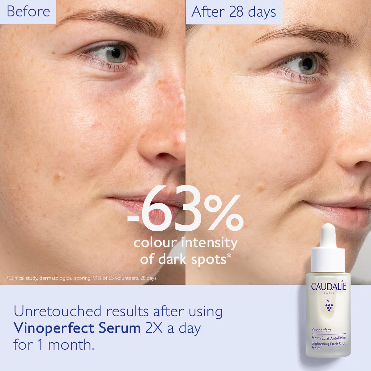  Caudalie Vinoperfect Dark Spot Brightening Serum – بديل فيتامين C لتفتيح البشرة 