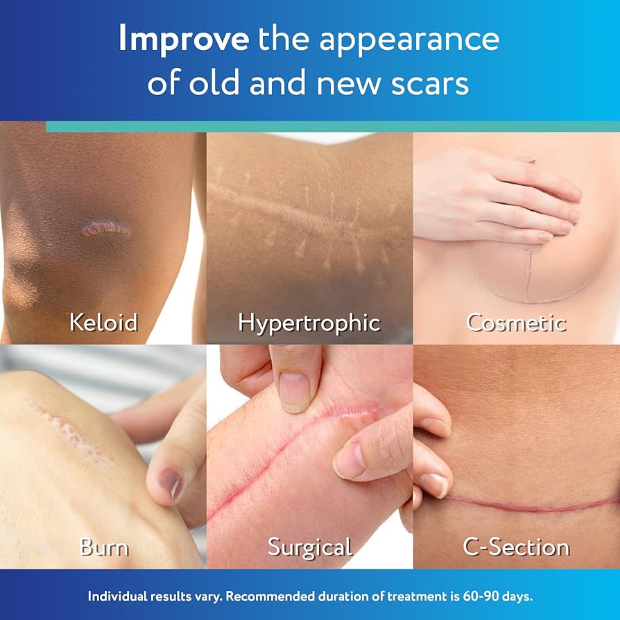  شرائح سيليكون شفافة من (scar away )متقدمة للندبات 1.5 × 3 بوصة – طبية الجودة لعلاج ندبات العمليات والحروق والجدرة (6شرائح 