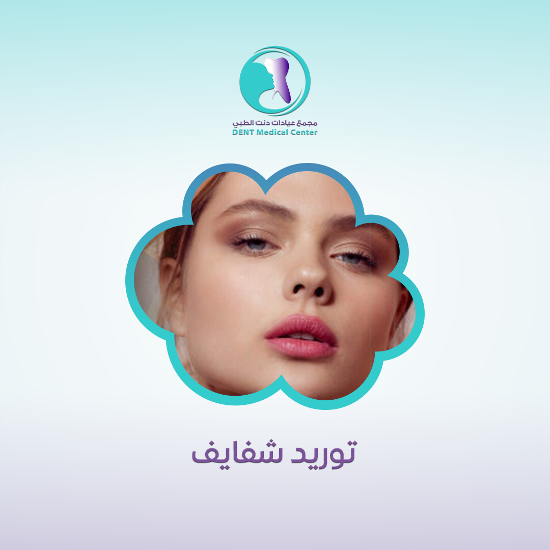 توريد شفايف