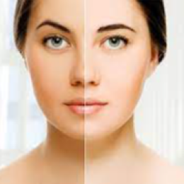 Moisturizing and skin lightening creams