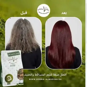 صورة مصغرة 4