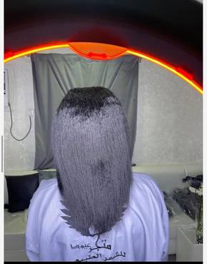 صورة مصغرة 2