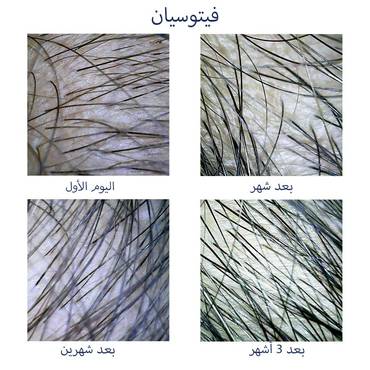 صورة مصغرة 2