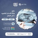 علاج وازالة  الاسنان المطموره  داخل العظم