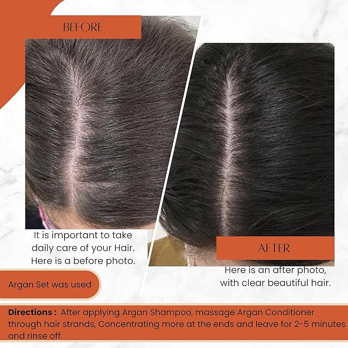 Moroccan Argan Oil Shampoo - Cold-Pressed Argan Oil to Help Moisturize, Soften & Strengthen Hair for Damaged & Dry Frizzy Hair - Anti Hair Loss - Extra hydrating 500ml B41 \ 8052742452182 - صورة 8