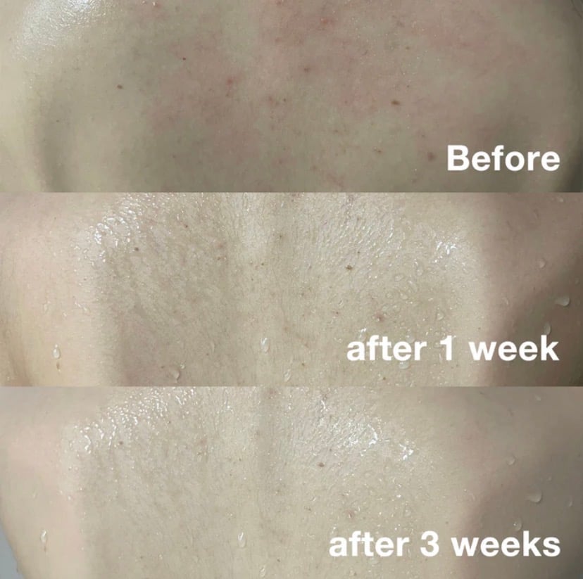 Medicube Red Body Wash - Image 5
