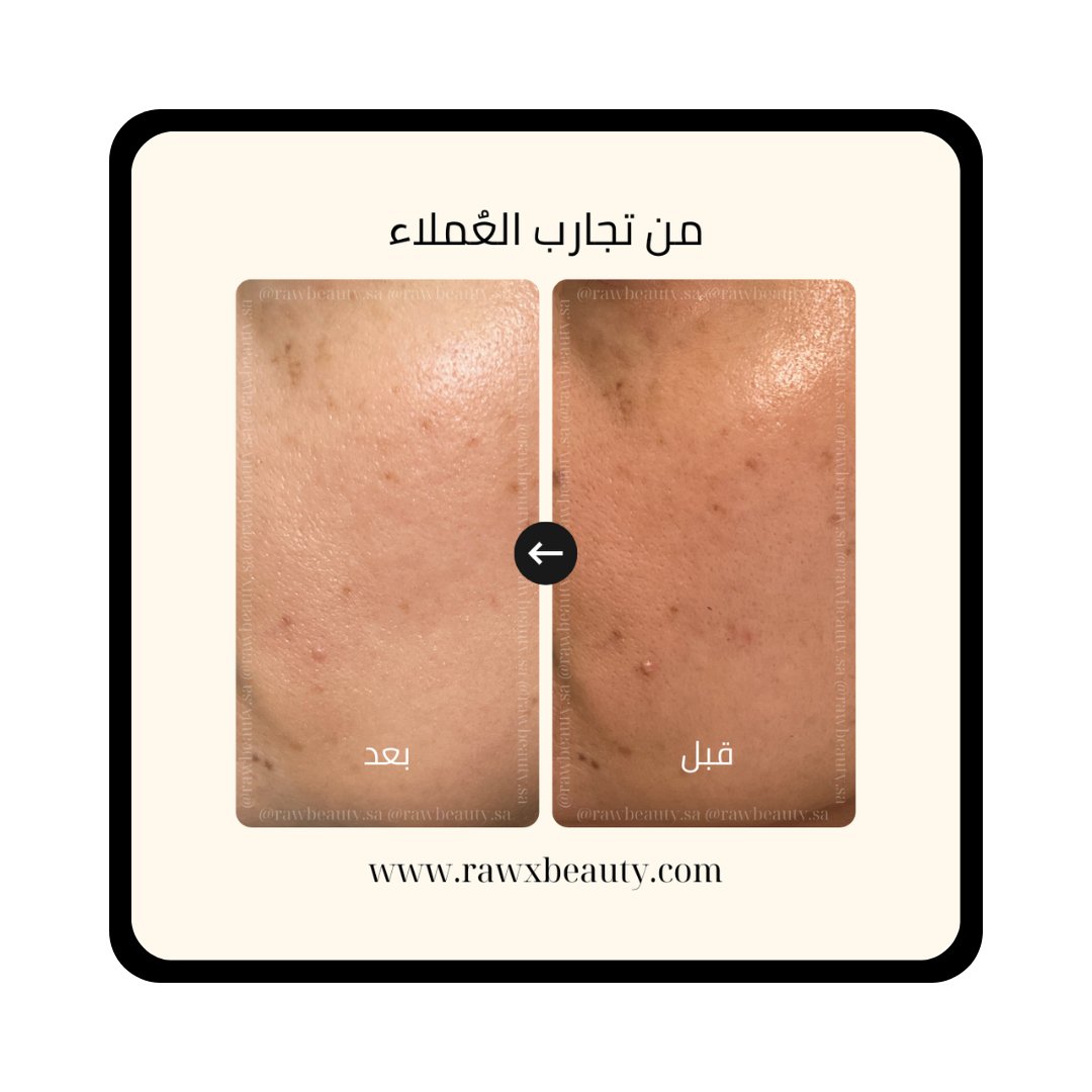 Brightening Face Line Set - Image 3