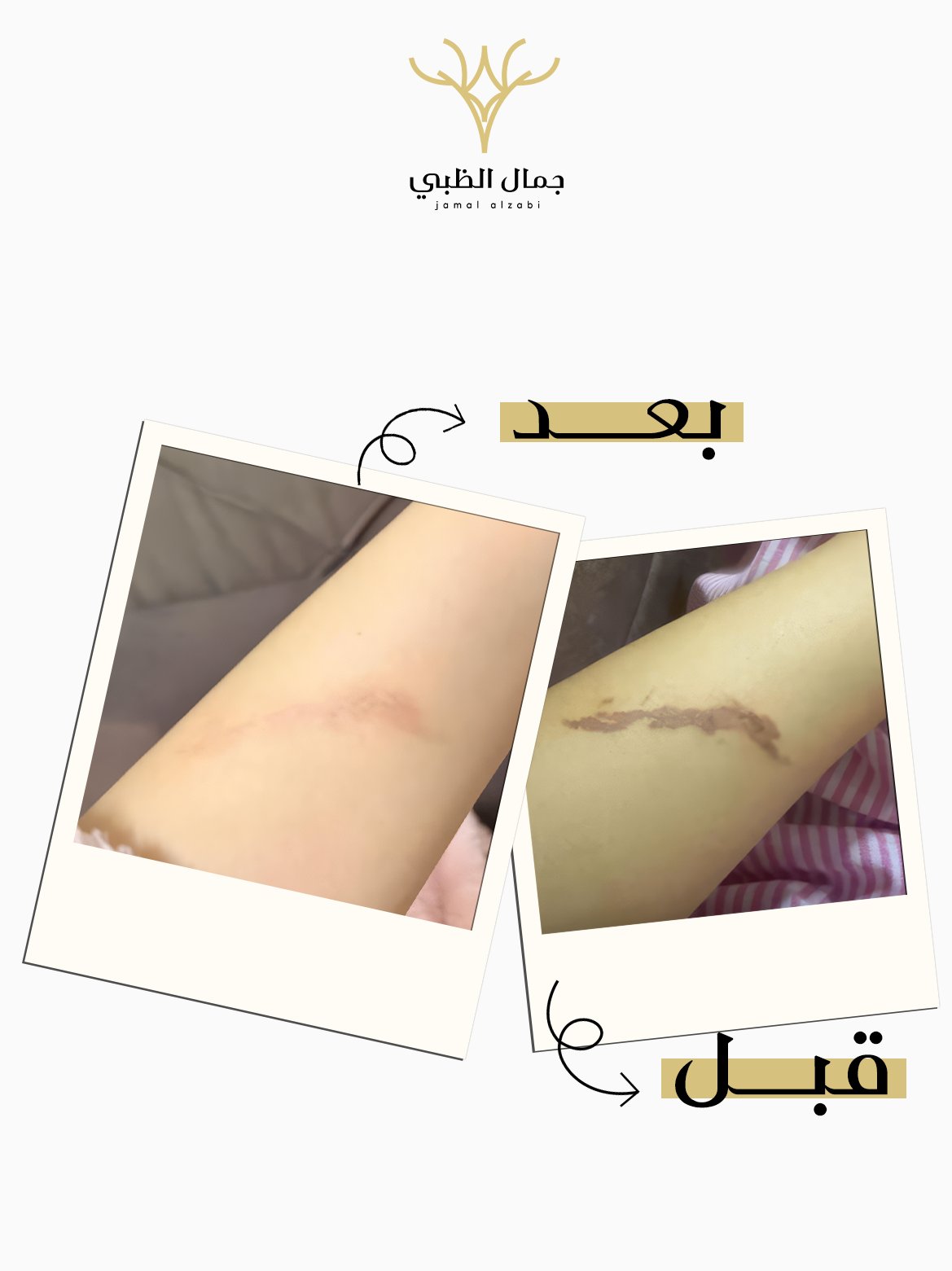 عرض 2  بوكس البكج الشامل - صورة 5