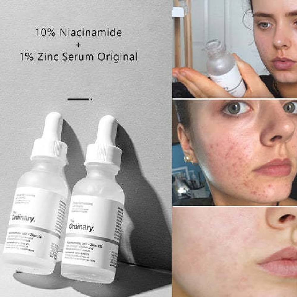 The Ordinary Niacinamide 10% + Zinc 1% Oil Control & Blemish Serum – 30ml - Image 3