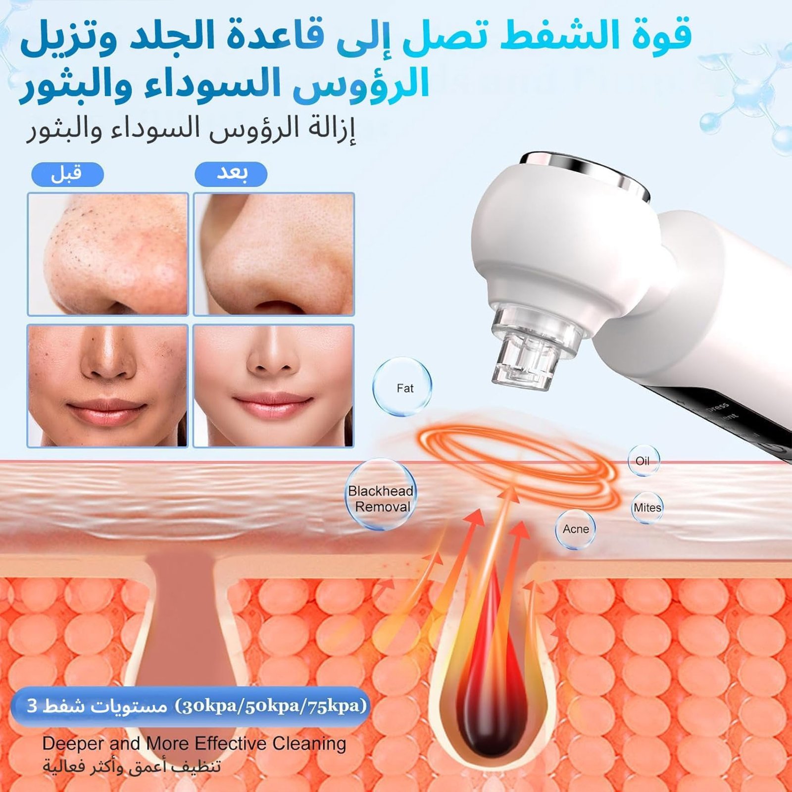 جهاز إزالة الرؤوس السوداء وشفط المسام مع 3 مستويات من الشفط - صورة 4