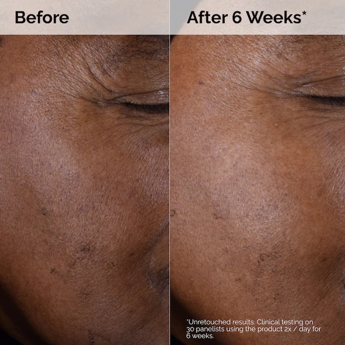 The Ordinary Glycolic Acid 7% Exfoliating Toner 240ml - Image 8