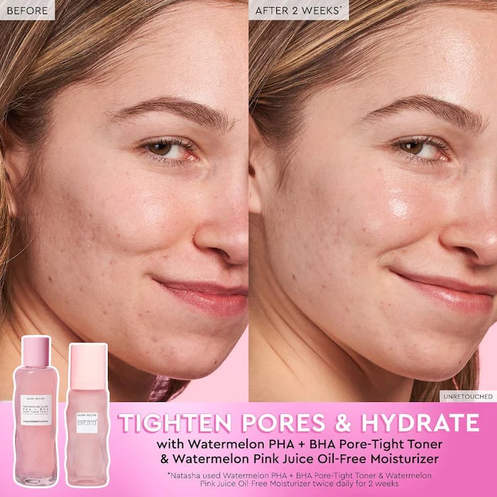 Glow Recipe Watermelon Glow PHA + BHA Pore-Tight Toner - Image 4