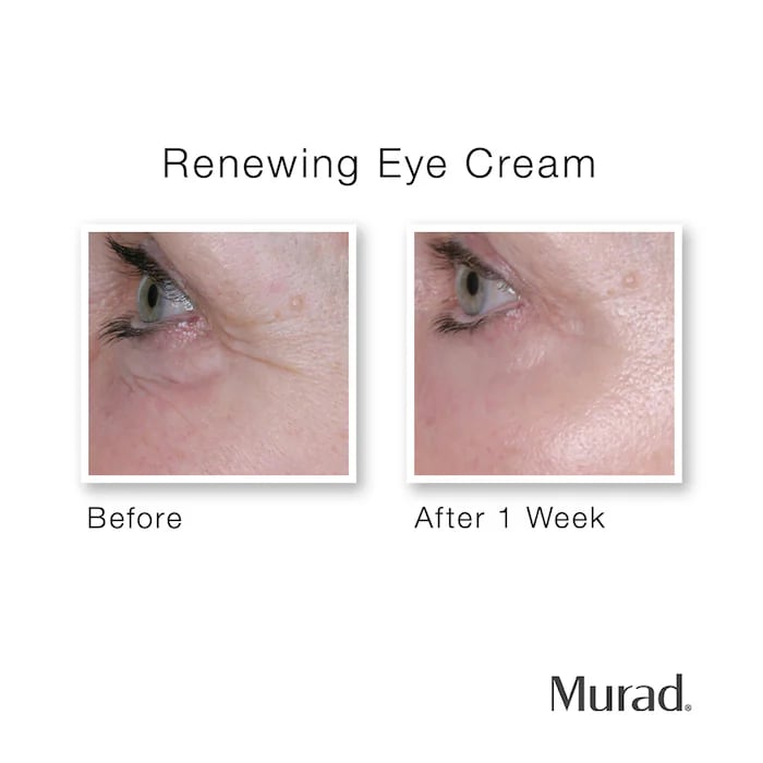 Murad Renewing Eye Cream - Image 3