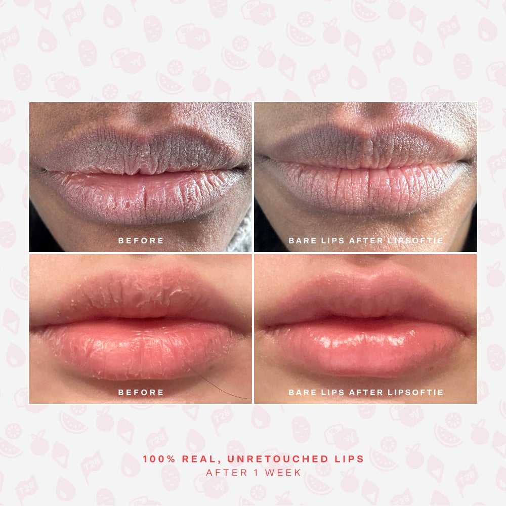 Tower28 LipSoftie® Lip Treatment - Image 7
