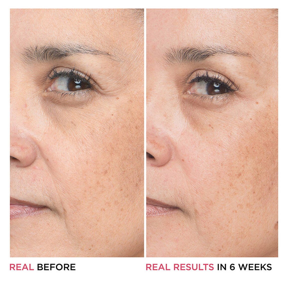 it cosmatics BYE BYE LINES HYALURONIC ACID SERUM - صورة 4