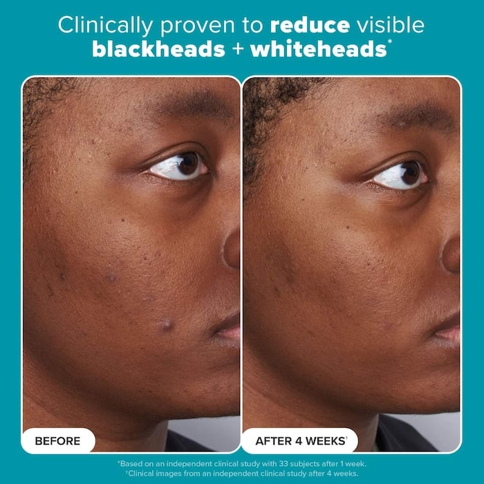 Paula's Choice  Skin Perfecting 2% BHA Liquid Exfoliating Toner for Clear Skin - Image 5