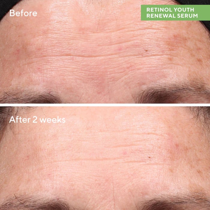 Murad Retinol Youth Renewal Serum 15 ml - صورة 2