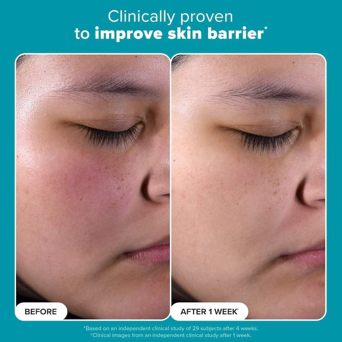 Paula's Choice  Skin Perfecting 2% BHA Liquid Exfoliating Toner for Clear Skin - Image 10