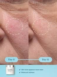 ELEMIS DYNAMIC RESURFACING FACIAL PADS - Image 5