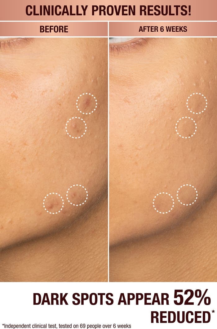 Charlotte Tilbury  Dark Spot Correcting Radiance Recovery Serum - صورة 6
