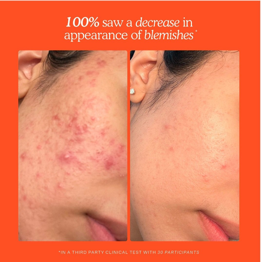 Tower 28 Beauty  SOS Daily Hypochlorous Acid Spray for Breakouts & Redness - Image 4