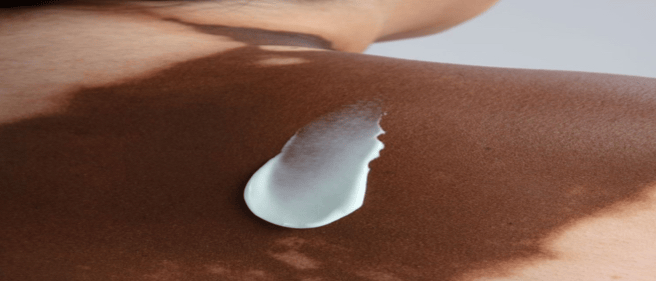 منتجات علاج التصبغات