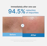 Medicube Zero Pore Blackhead Deep Cleansing Oil - Image 4