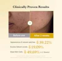 Medicube Kojic Acid Tumeric Toner Pad - Image 3
